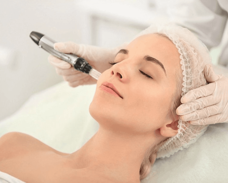 ✨Microneedling con activos puros