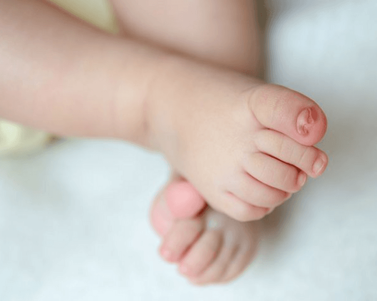 Podología Infantil (Pie Sano)