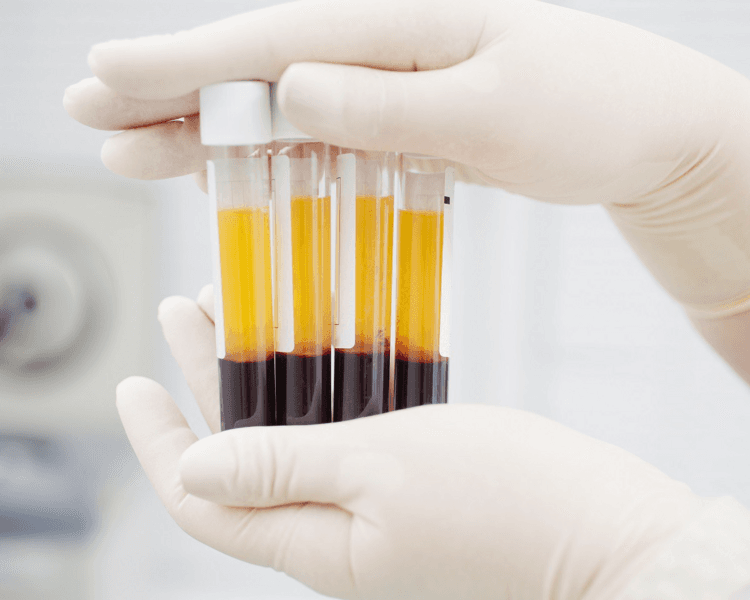 Plasma rico en plaquetas facial + capilar