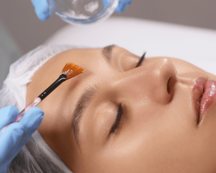 Peeling químico facial (1 sesión)
