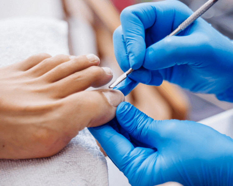 Retirada de Semipermanente y Pedicura