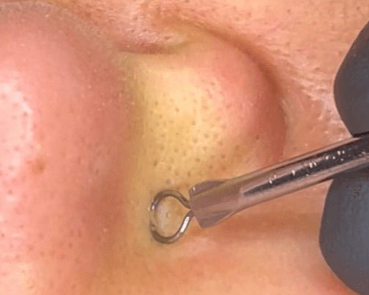 Limpieza con extraccion