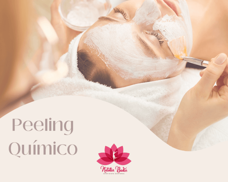 Peeling Quimico