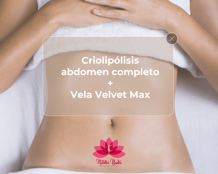 Promo Criolipólisis Abdomen Completo + Vela Velvet