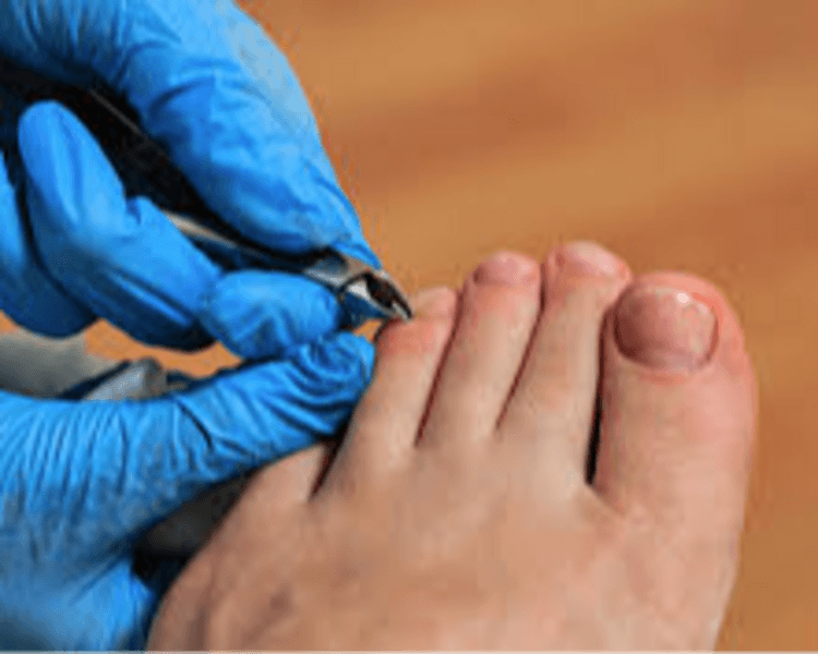 🛡️ Carilla inmovilizadora o puente PAE (hasta 2 Hallux)