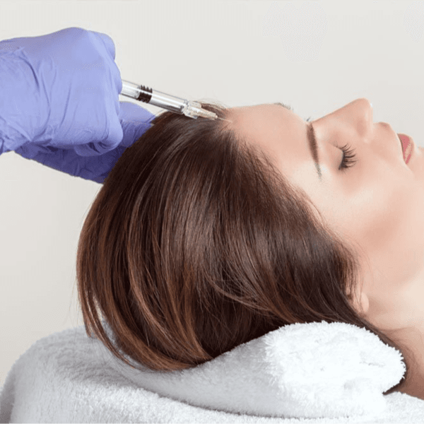 Mesoterapia Capilar