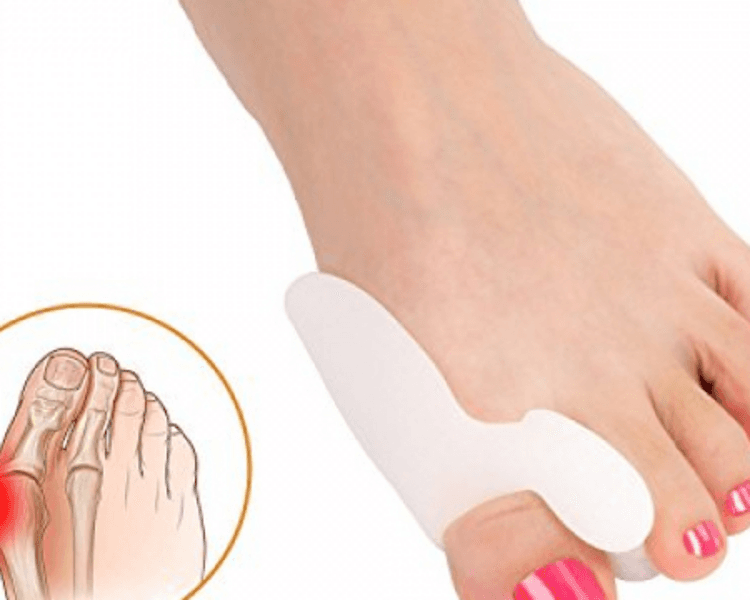 🧪 Implantes temporarios o sellado antimicótico (hasta 2 Hallux)