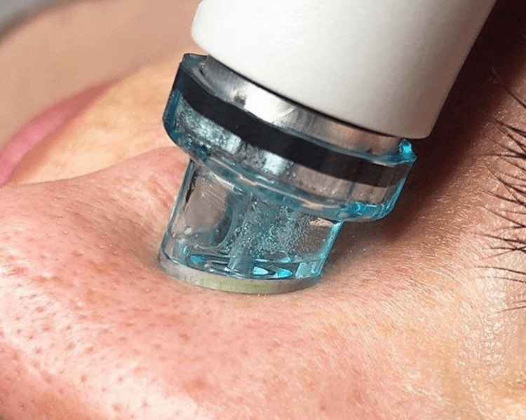 Punta de diamante + Mascarilla