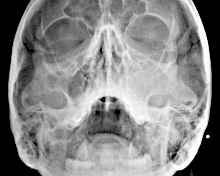 RX 8 RADIOGRAFIA CADWELL