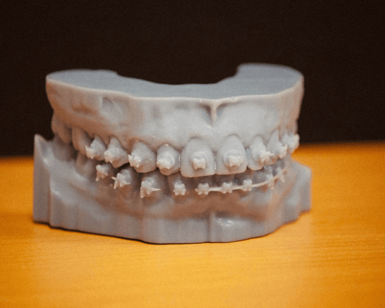 ESTUDIO COMPLETO DE ORTODONCIA CON TOMOGRAFIA Y MODELOS 3D