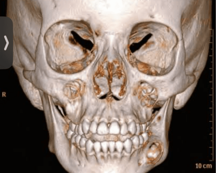 TOMOGRAFÍA PARA ORTONDONCIA