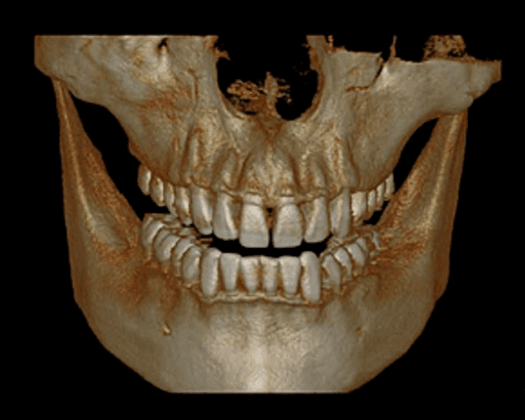 TOMOGRAFIA AMBAS ARCADAS