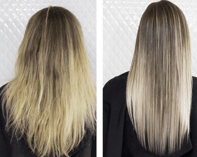 BOTULINICA YBERA PARIS