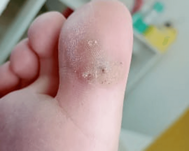 PEDICURÍA CON TORNO