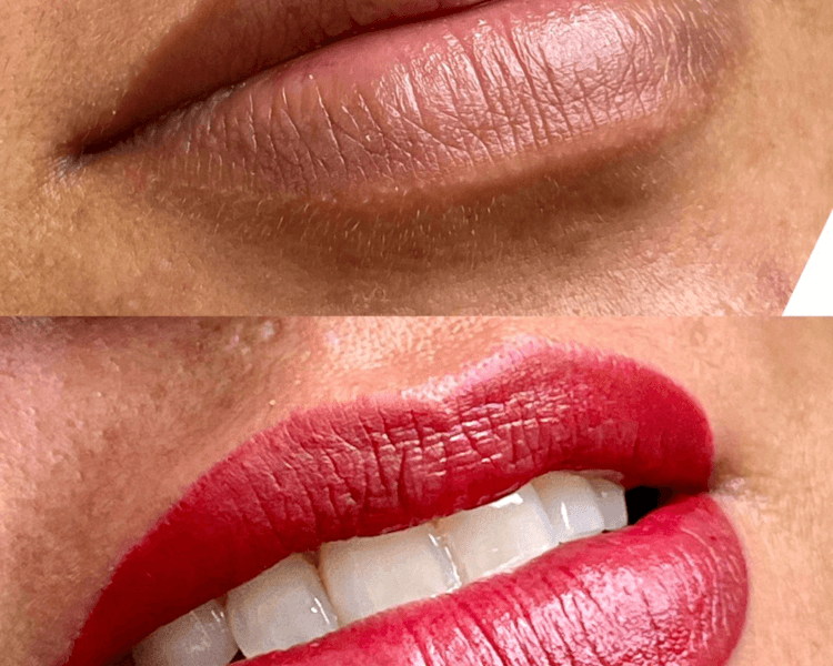 Neutralización de labios manchados + Color deseado
