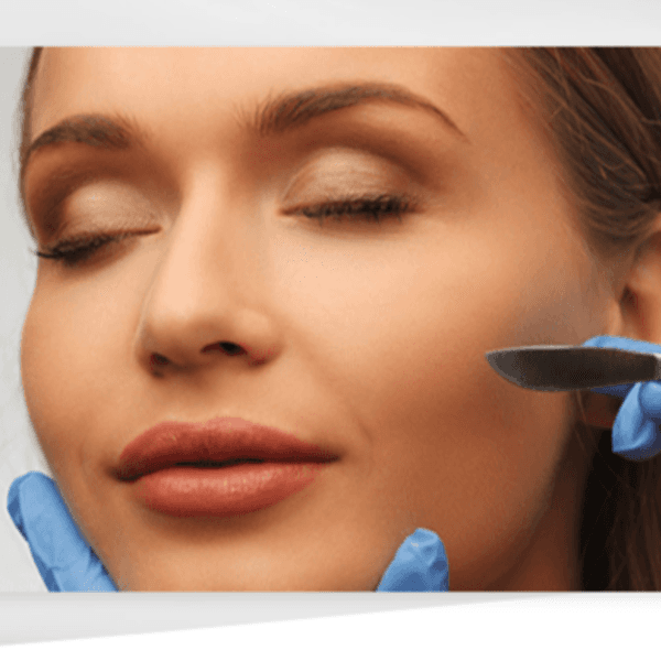 DERMAPLANING