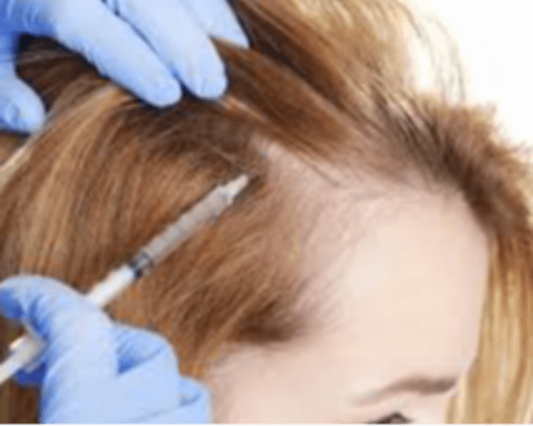 MESOTERAPIA CAPILAR DR. FRIDMANIS