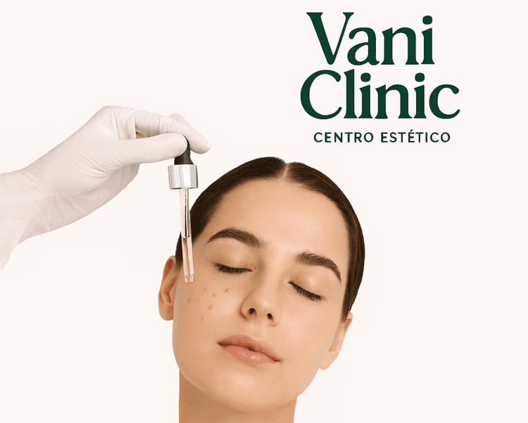 DESPIGMENTACION FACIAL CON ACIDOS