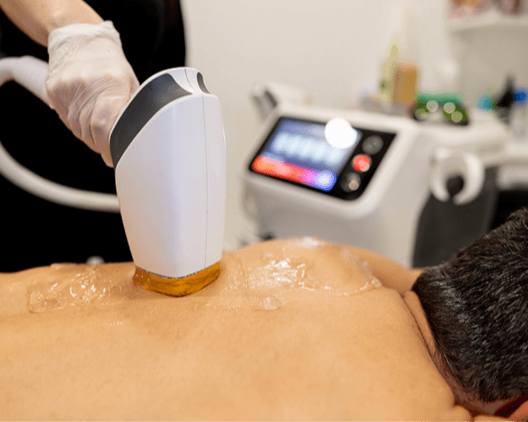 Láser espalda completa 1 sesión