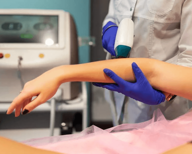 Láser medios brazos 1 sesion