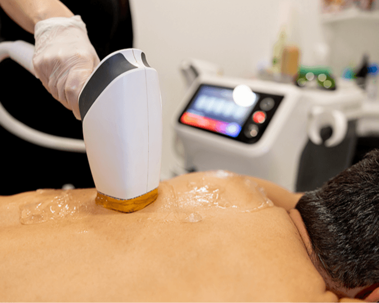 Láser media espalda 10 sesiones