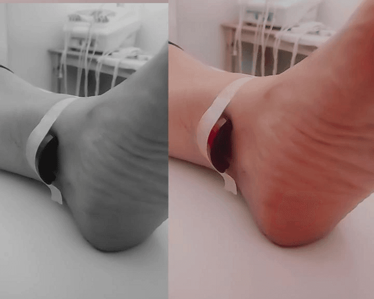 Reflexologia Podal + Magnetoterapia