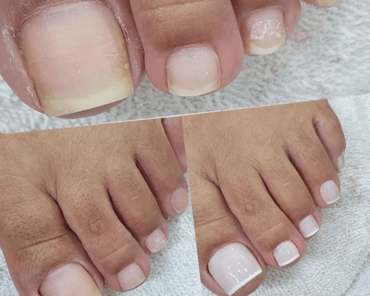 pedicuria + esmaltado semi