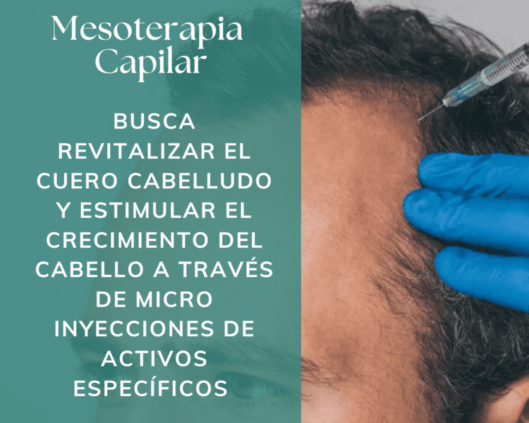 Mesoterapia Capilar