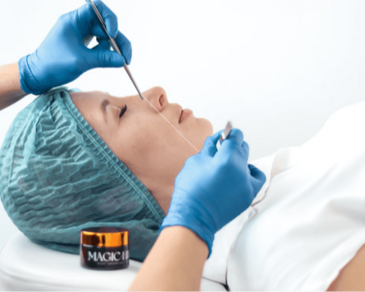 Hilos tratamiento básico