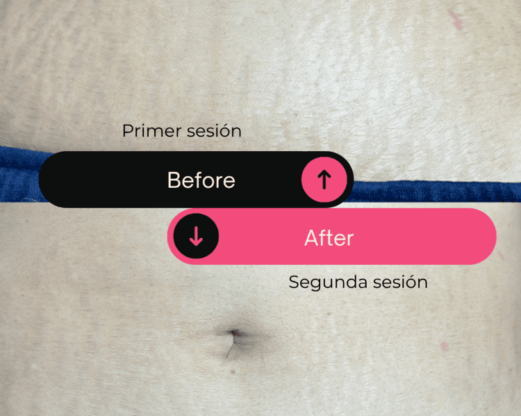 Zona mediana 6 sesiones