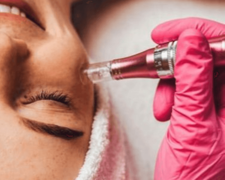FACIAL + DERMAPEN X4 SESIONES