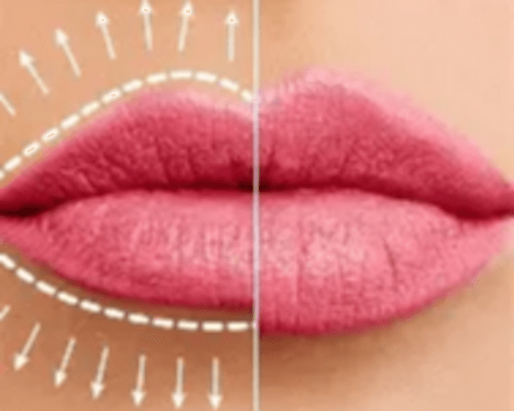 ARMONIZACIÓN DE LABIOS
