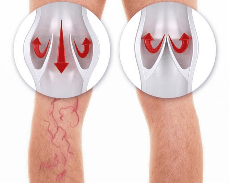 Drenaje Linfático (Superior o Inferior) MUJER