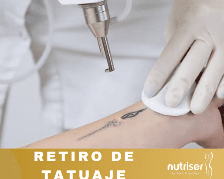 Eliminación o Desvanecimiento de Tatuajes