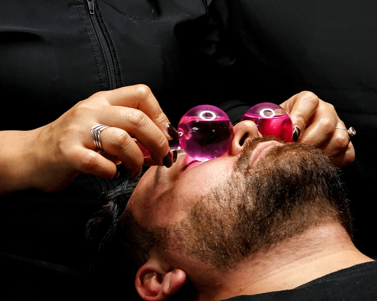 Epilación Facial Man