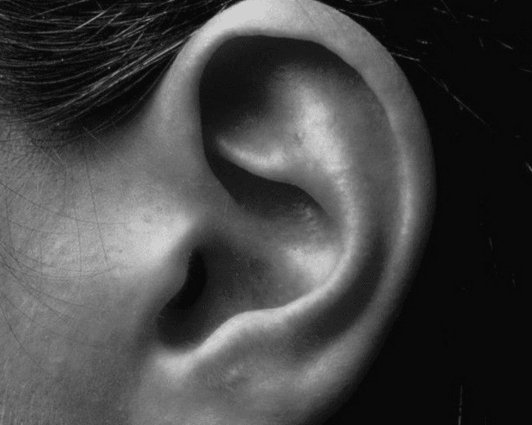 Epilacion Extra o Sectorizada👂🏻👃🏻 (nariz interna, oído y cuello)