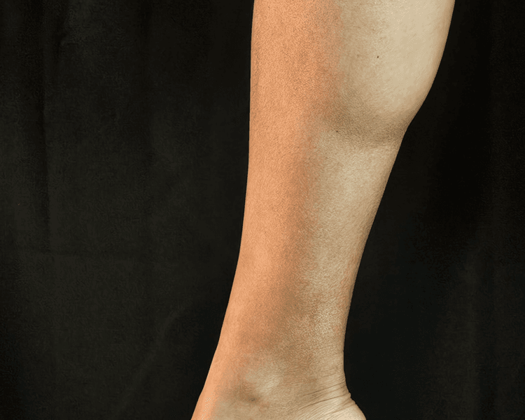 Media Pierna 🦵🏻