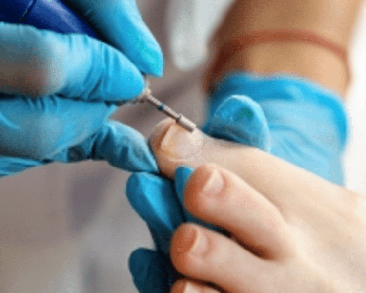 Pedicuría con Tratamientos Especiales