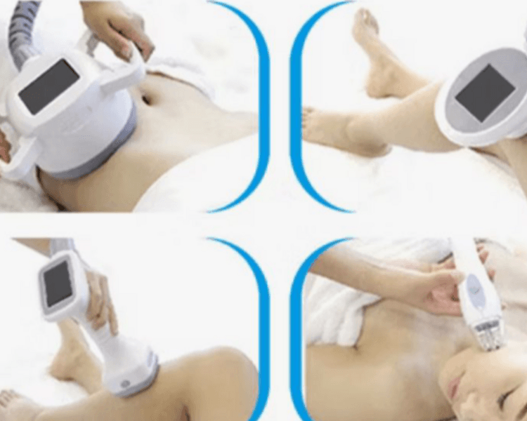 VELASHAPE VACUUM ROLLER