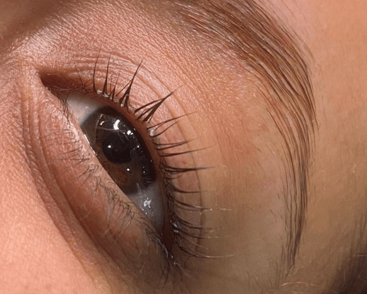 Lifting + botox + keratina