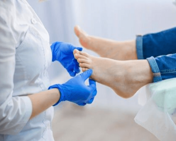 Control Uña Encarnada