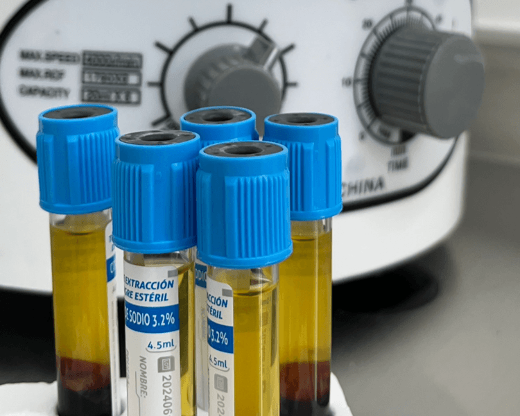 Plasma rico en plaquetas