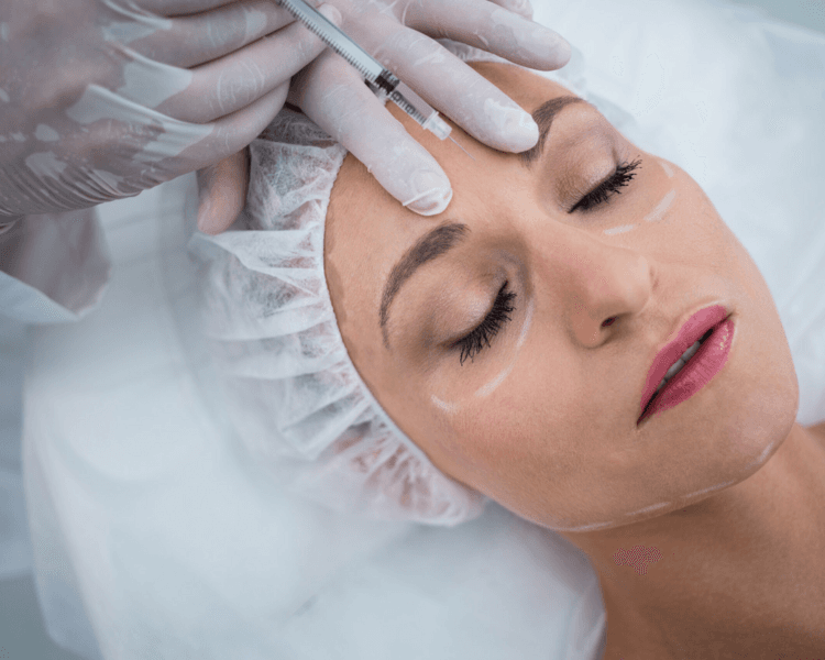 💉Toxina Botulínica – Tercio Superior Facial (4 Zonas + Retoque)