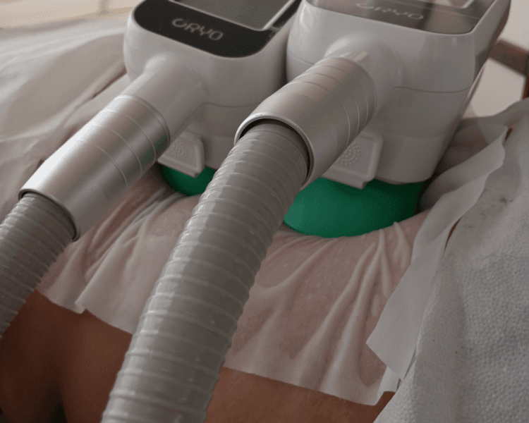 Tratamiento Reductivo con Criolipólisis