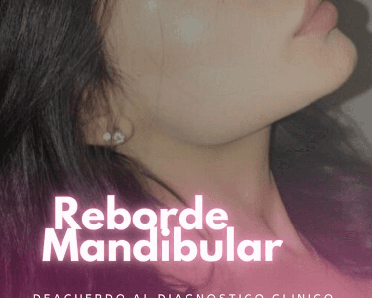 Reborde Mandibular