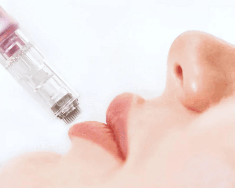 💋 Hidralips con Dermapen (*Servicio exclusivo como complemento de algún tratamiento)