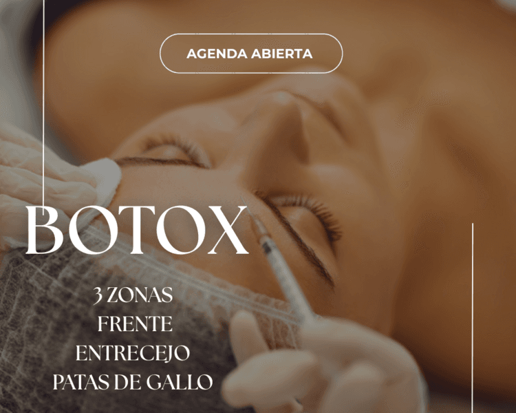 Botox Tercio Superior (entrecejo + frente + patas de gallo)