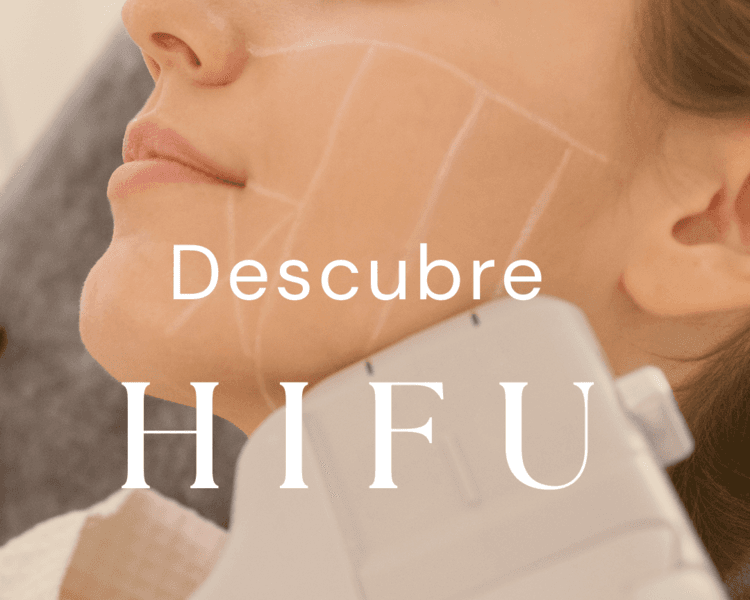 HIFU Zona Patas de gallo
