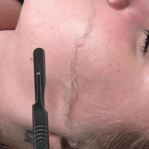 Glow Facial Signature + Dermaplaning