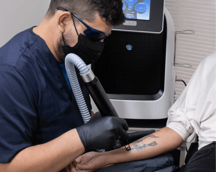 Eliminación de tatuajes